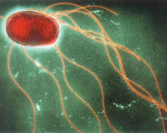 生腌海鲜有寄生虫吗，什么海鲜可以生腌（女子上网学做生腌虾食物中毒）