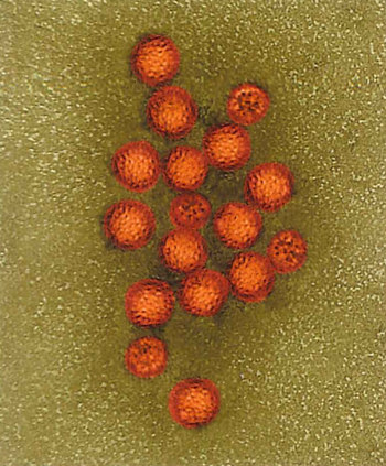 生腌海鲜有寄生虫吗，什么海鲜可以生腌（女子上网学做生腌虾食物中毒）