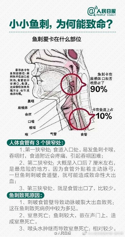 异物卡喉的急救方法，幼儿异物卡喉的急救方法（异物卡喉，这些急救法都是错的）