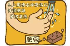 消毒和杀菌有什么区别，消毒和灭菌有何区别（不可小瞧的“狂犬病”）