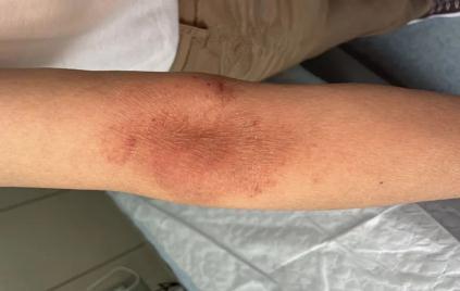 怎么给百瓶设置个人简介，竟把自己送进医院