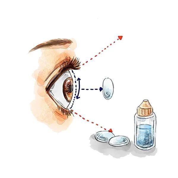 隐形眼镜怎么分正反面，隐形眼镜怎么分正反（隐形眼镜，你到底戴对了吗）