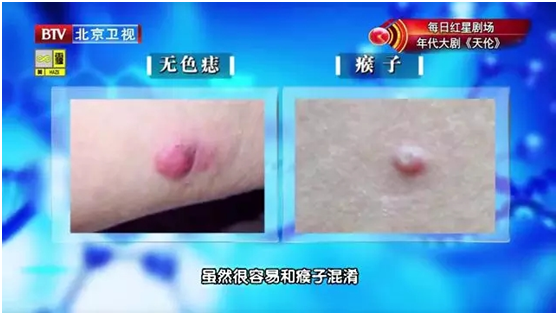 脸上无缘无故出现红块，脸上无缘无故红了一块还痒（出现这6种变化）