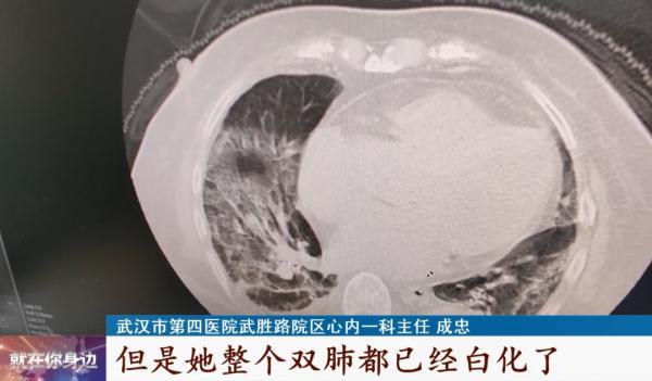 x加x分之一的图像，如何画出函数y=x+1/x的图像（没发烧不咳嗽，一查双肺都白了）