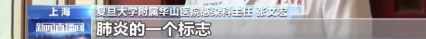 高情商回复别人的邀请，回复别人的邀请怎么说（“白肺”变多了）