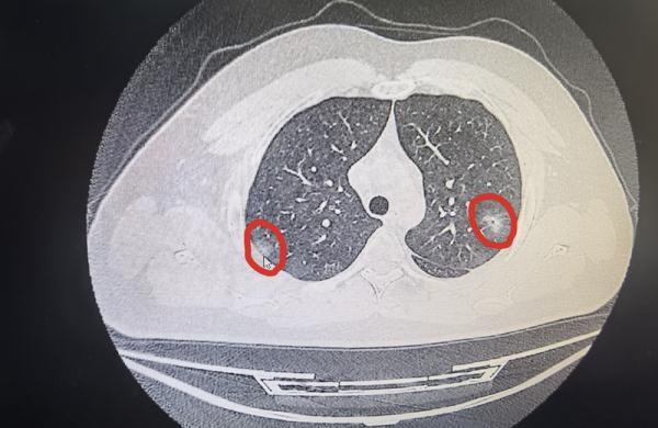 怎么才能约上附近的人，微信附近的人怎么约100%成功（“阳康”们有必要拍CT吗）