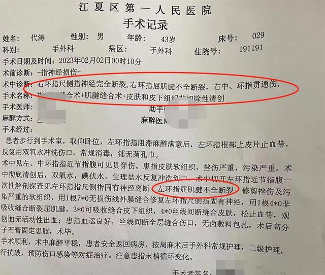 手里扎刺取出妙招，手上扎刺还在用针挑（武汉江夏民警代涛以手挡刀救自残轻生女子）