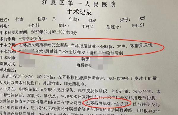 手里扎进小刺了弄不出来怎么办，手上扎进小刺很疼却挑不出来怎么办（他被连刺三刀，仍不松手……）